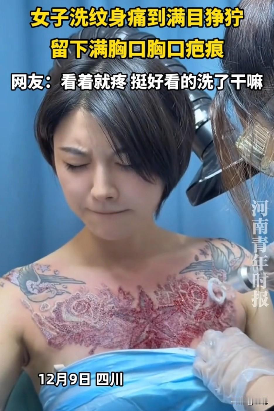 四川一女子决定洗掉胸口大面积的纹身，痛得面目狰狞，最后留下满胸口的疤痕。都说