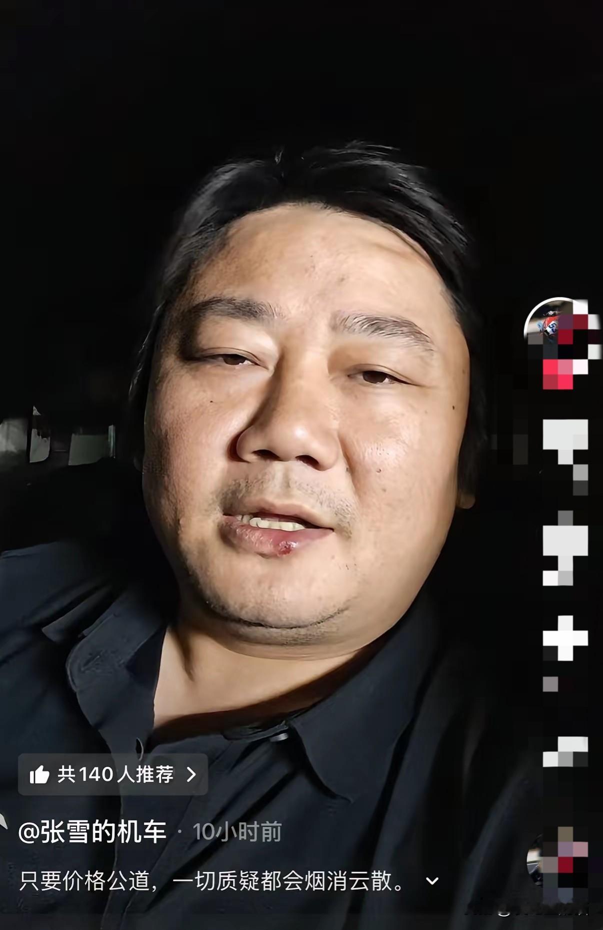于东来力挺韩红的热搜还没凉，张雪凌晨一句话又炸锅了！张雪直言：“这事儿好解决，把购车合同、票据全晒出