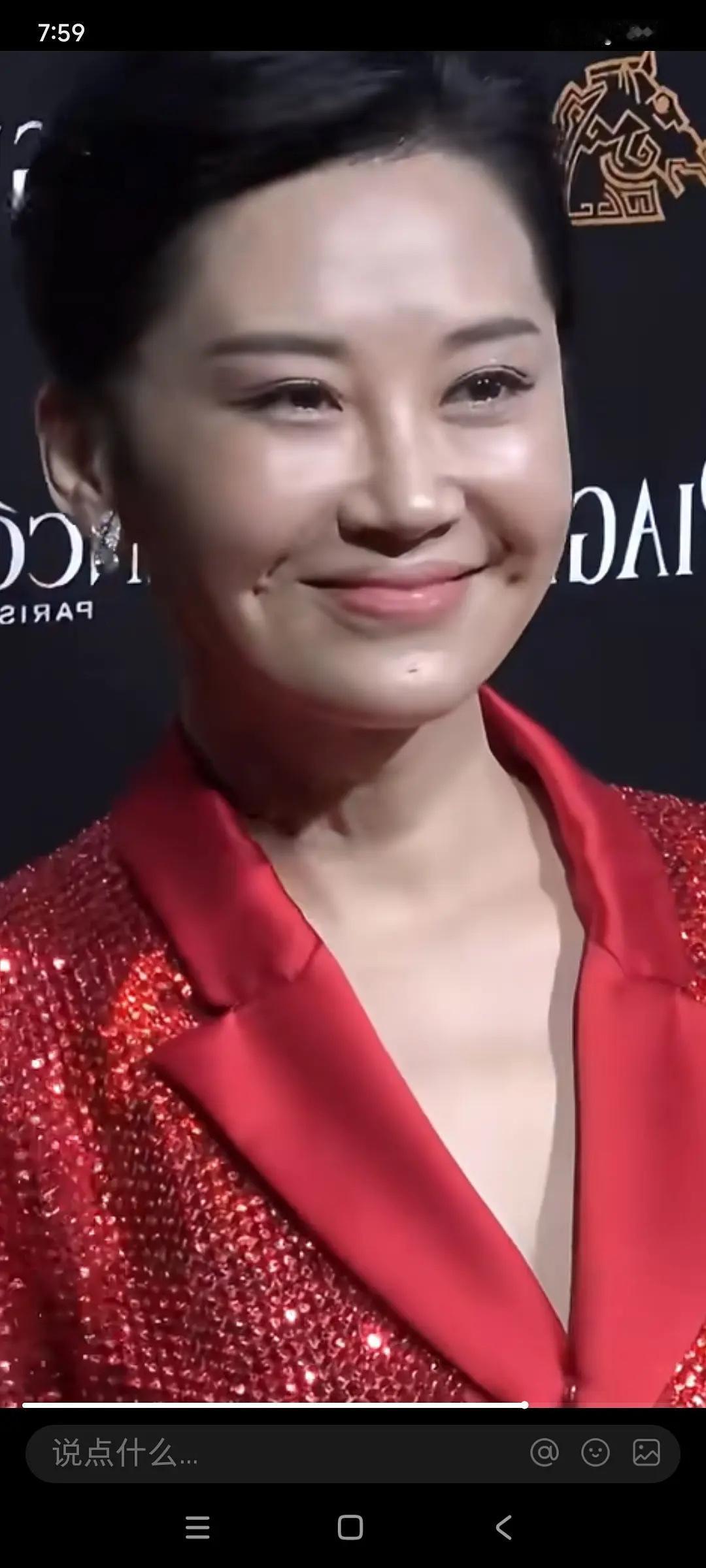 第一眼没看出来是谁，第二眼才看出来这是许晴。好家伙，这是往脸上注射了什么物质