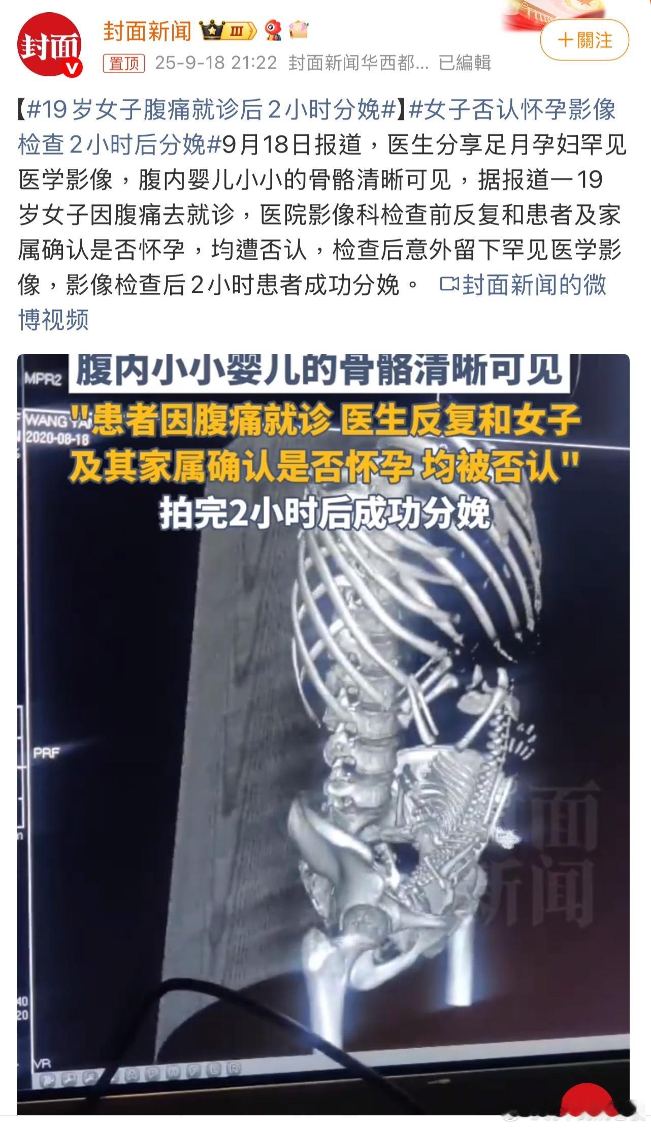 19岁女子腹痛就诊后2小时分娩腹痛就医竟在2小时后分娩，夏天衣服这么薄，孕肚怎