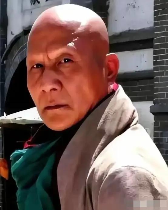 17岁那年，计春华给自己煎了锅中药，锅是铝的。长期煎煮服用后，他的头发、眉毛，一