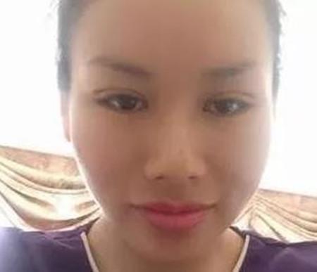 双眼皮和开眼角后眼皮看上去没什么痕迹