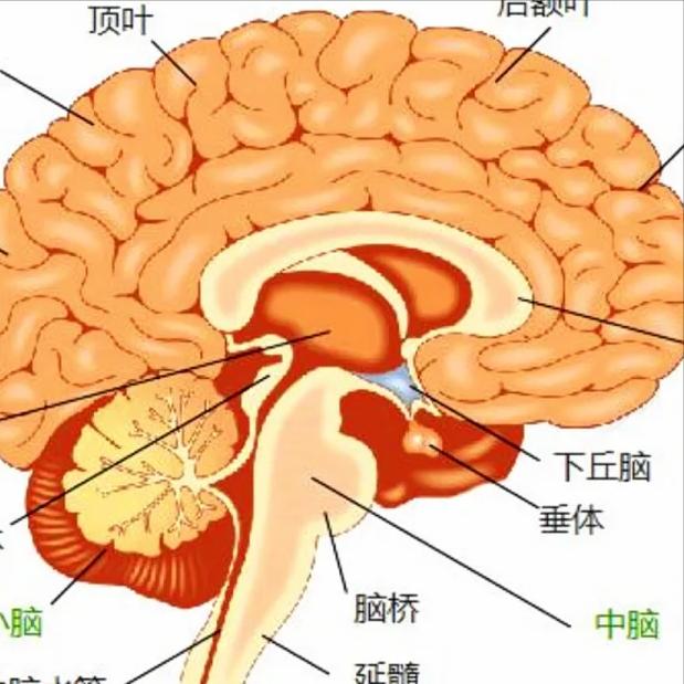 脑出血“三偏”问题不解决，生活就乱套了 一、偏身运动障碍：这是偏瘫最明显的