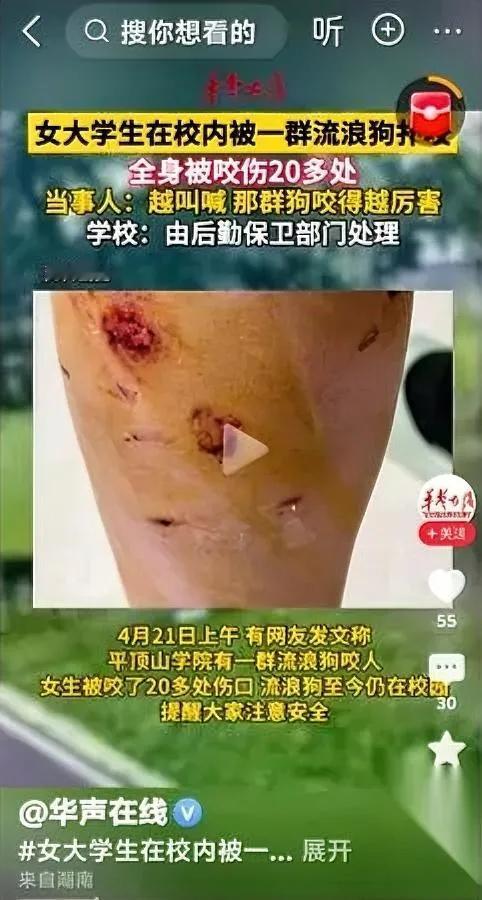 流浪狗咬人了爱狗人士去哪了为啥当初闹得沸沸扬扬，现在全成了哑巴？两年