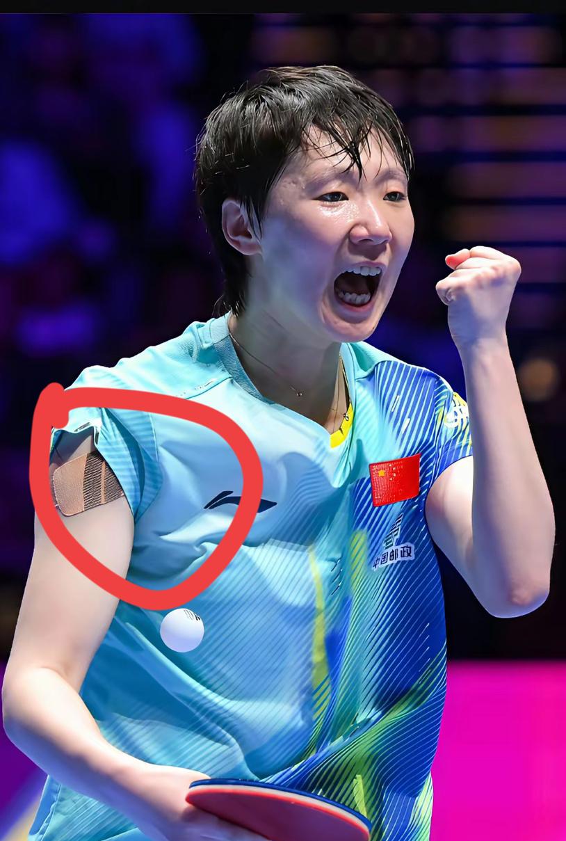 王曼昱不但把胳膊上的胶带拆了，还参加了活动，孙颖莎也在。王曼昱和孙颖莎等