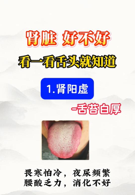 在中医理论中，舌诊是辨证参考手段之一，可辅助判断肾脏相关的虚损证型。下面为大家介