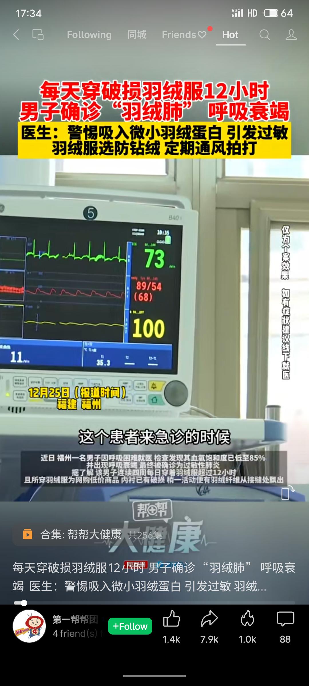 福州一男子连续四周每日穿破损羽绒服超12小时，吸入羽绒纤维后引发过敏性肺炎（俗称