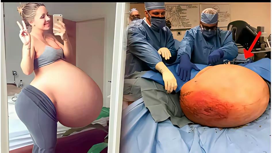 腰都快压断了！这女人怀孕真不容易[赞][赞][赞][赞][赞][赞]