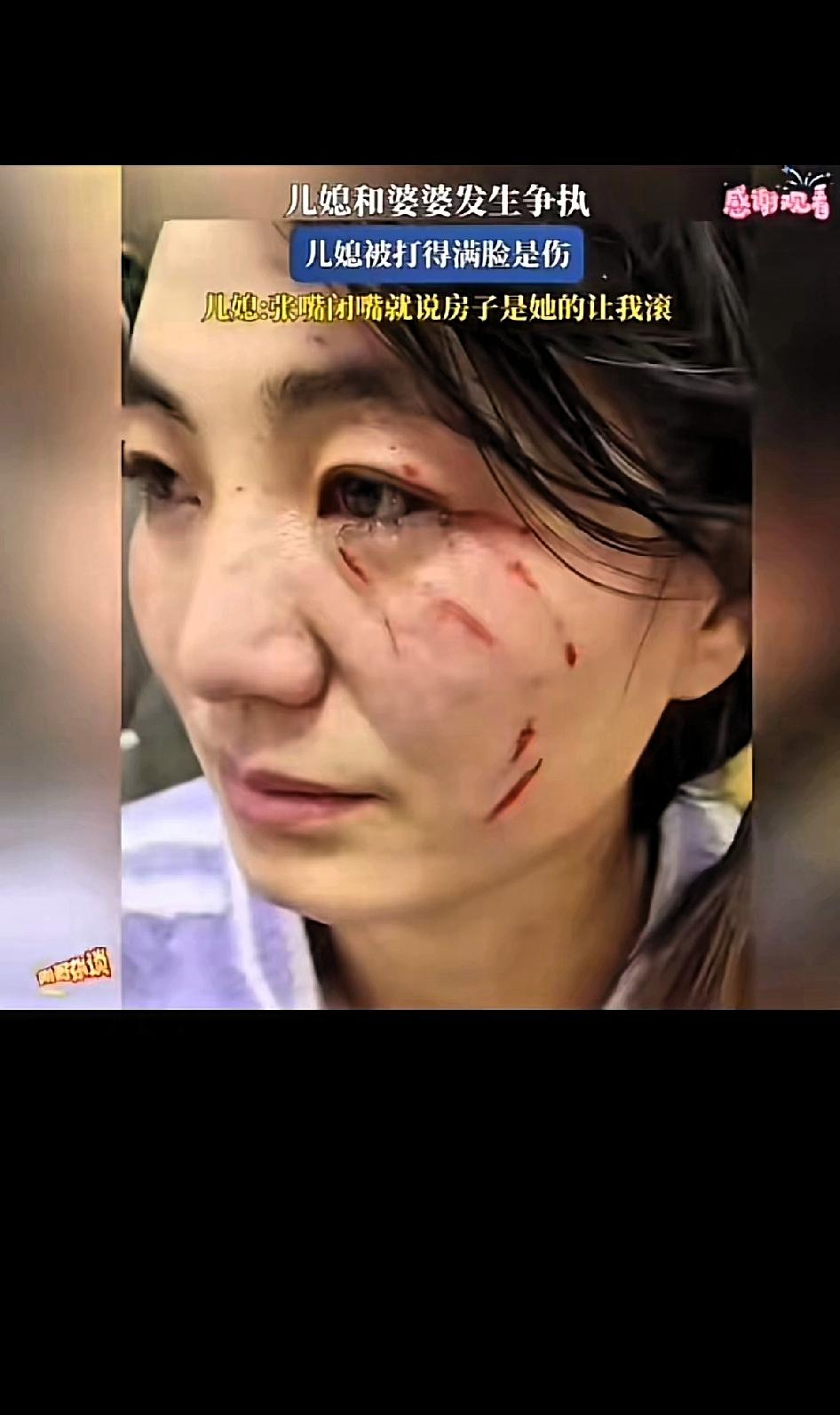 婆媳拌嘴常见,但动手抓得满脸是伤,还喊着“这是我的房”赶人,真是刷新三观!