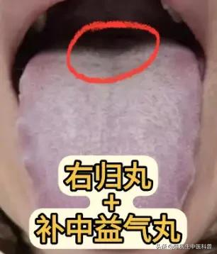 右归丸+补中益气丸：温阳益气，专治阳虚气虚型勃起不坚大家好，我是陈大夫！