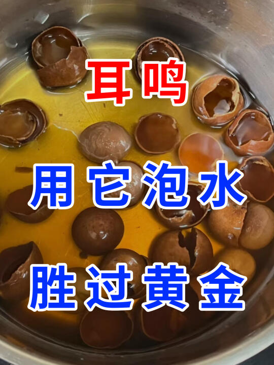 耳朵里持续的蝉鸣、嗡嗡声，是耳鸣发出的求救信号。长期戴耳机、身处嘈杂环...