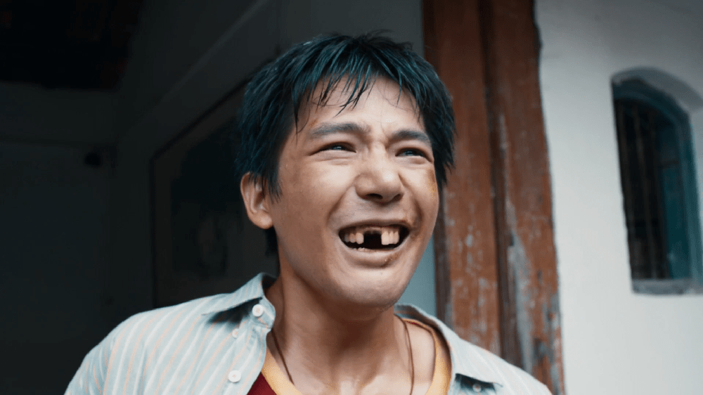 内娱什么时候才能明白，扮丑不等于演技好，看到王安宇新电影宣传片段，差点没敢认。