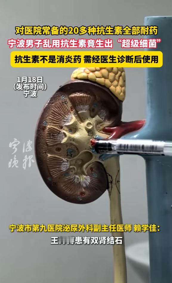“离了个大谱！”近日，浙江宁波，一男子因双肾结石且一侧肾脏丢失，导致他一有不舒服