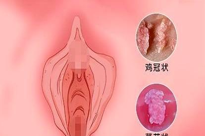 最近上厕所特别难受，感觉肛门那里像是被什么东西堵住了一样，每次拉大便都特别费劲，