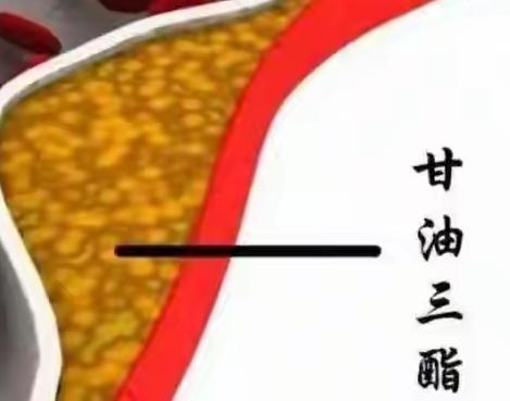 血脂高必须吃他汀类药物吗？今天去医院取体检报告，其它指标还都可
