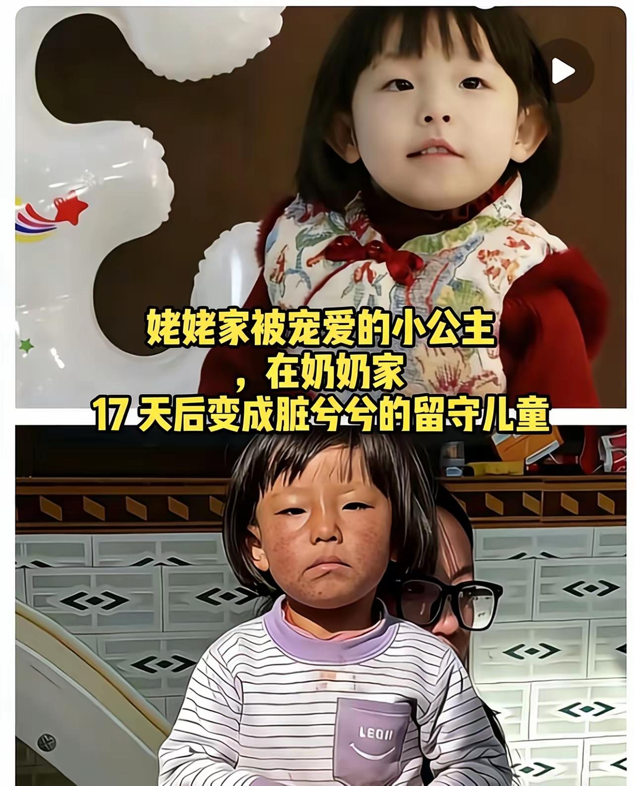 17天，涵涵从“小公主”变成“小可怜”，这反差看得人揪心到窒息！17天前，