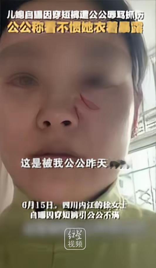 “清官难断家务事！”四川，一儿媳因天气热穿了条白色短裤，竟被50多岁的公公指着鼻