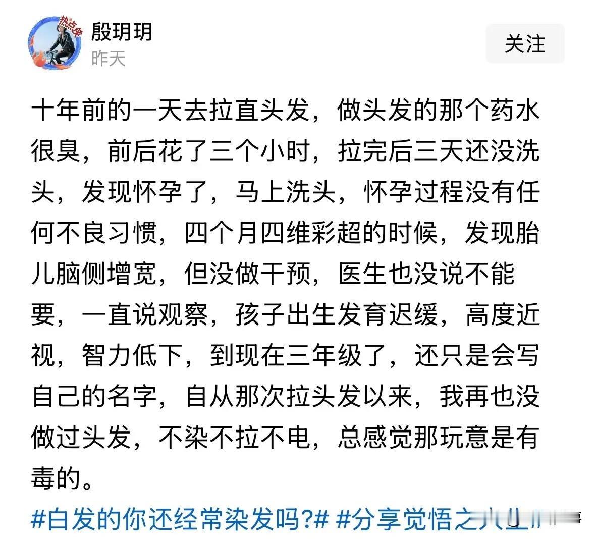 你染发吗？1、朋友以前年轻那会在理发店给人洗头，干了三年吧，然后学会理发自己给