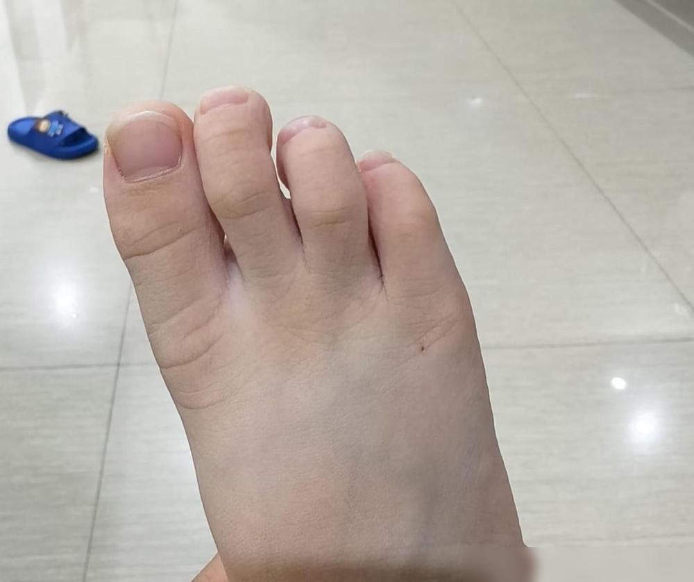 五岁的儿子昨天趴我耳边说，在妈妈肚子里时饿得慌，就自己吃掉了一个脚趾头。我当