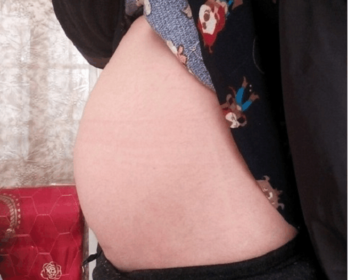 儿媳带娃看望婆婆, 宝宝长红疹送医后, 婆婆忍泪将“二儿子”送走