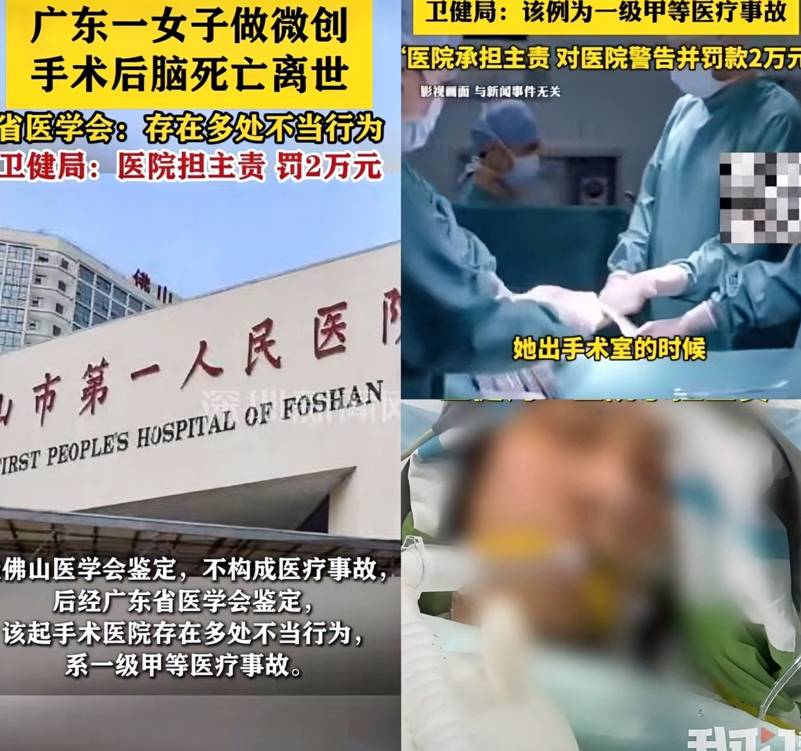 人命现在这么不值钱！34岁女子在佛山第一人民医院做微创手术，结果成了脑死亡去