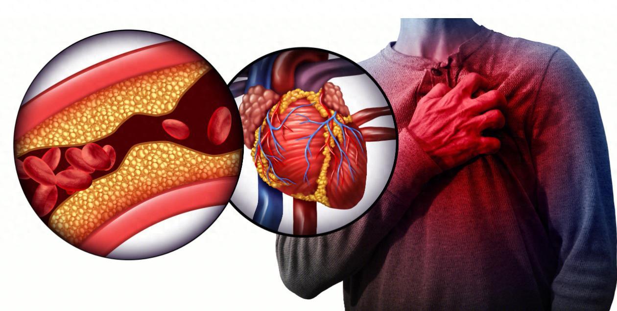 心脑血管的人，牢记一味药，专门清血管垃圾，一天比一天好作品声明：个人观点、仅供