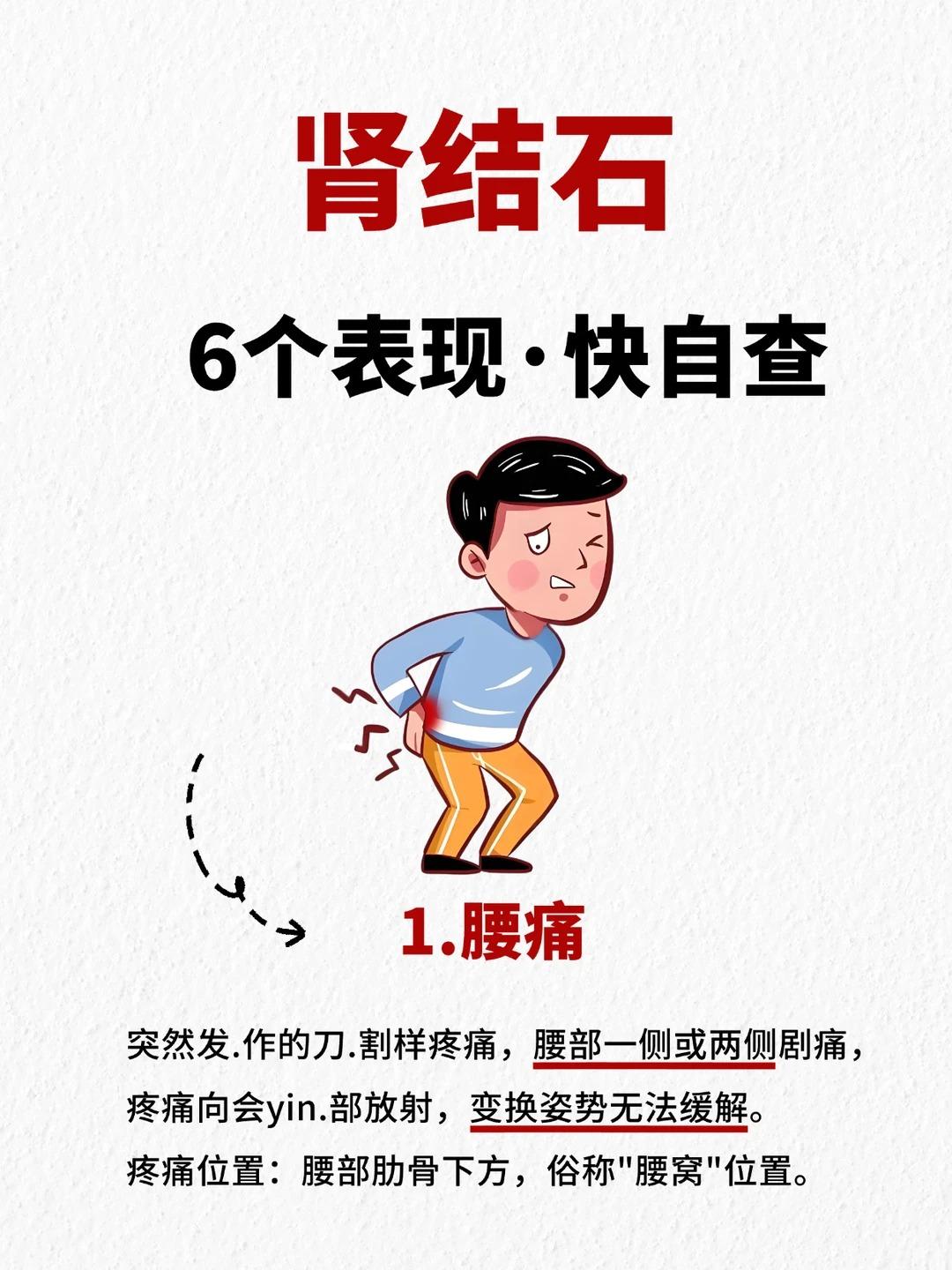 肾结石有6个表现！日常防护攻略赶紧码住！