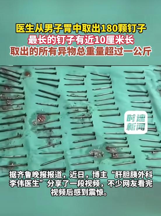 “真是活久见！”8月9日报道，云南，一男子长期吞食异物，觉得不舒服去医院时，检查