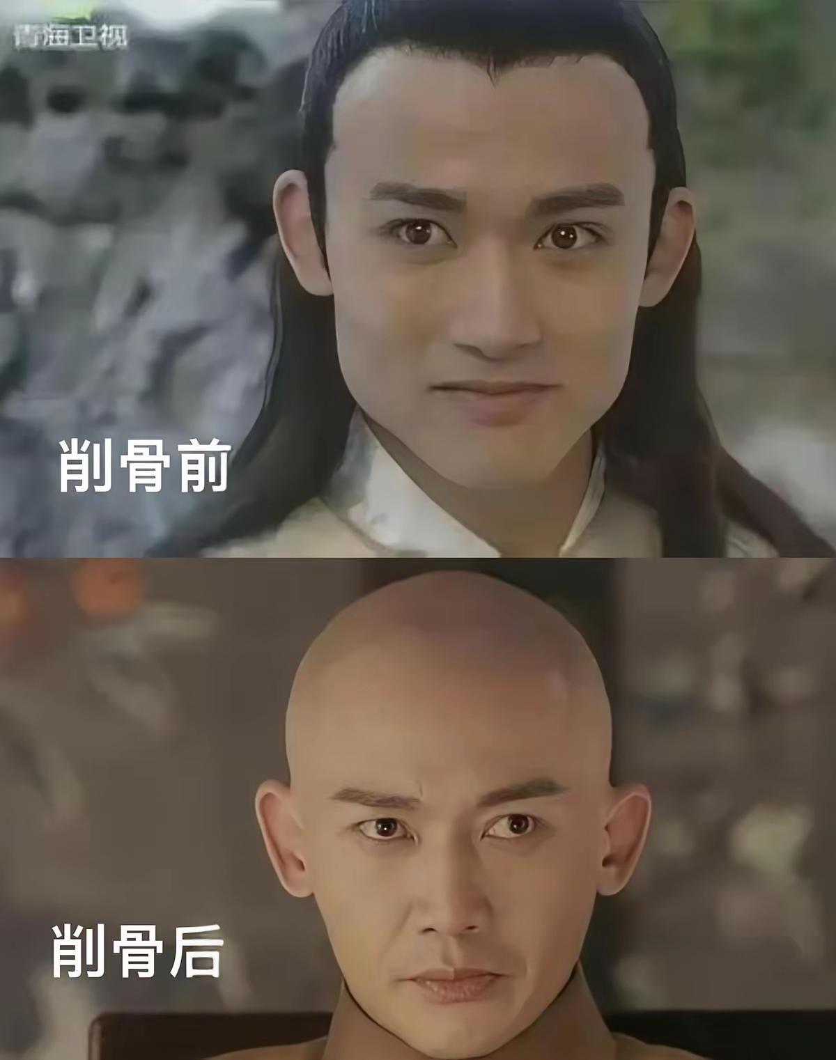 其实明星对自己狠起来，看着都怕。聂远这两腮帮削骨，想想就觉得疼，以后不能吃硬的