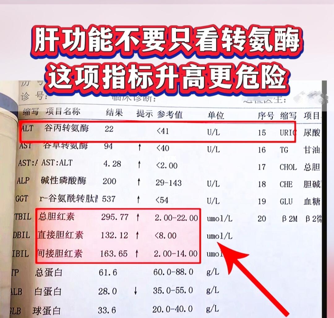 转氨酶正常不一定是好事！上午接诊了一位肝衰竭的患者，检查转氨酶不高，胆...
