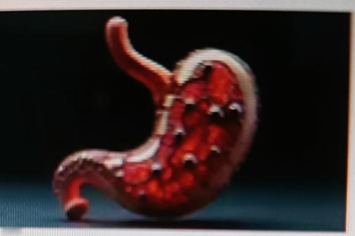 幽门螺杆菌是能在胃黏膜生存的细菌，是胃炎、胃溃疡甚至胃癌的重要诱因。它主要通过三