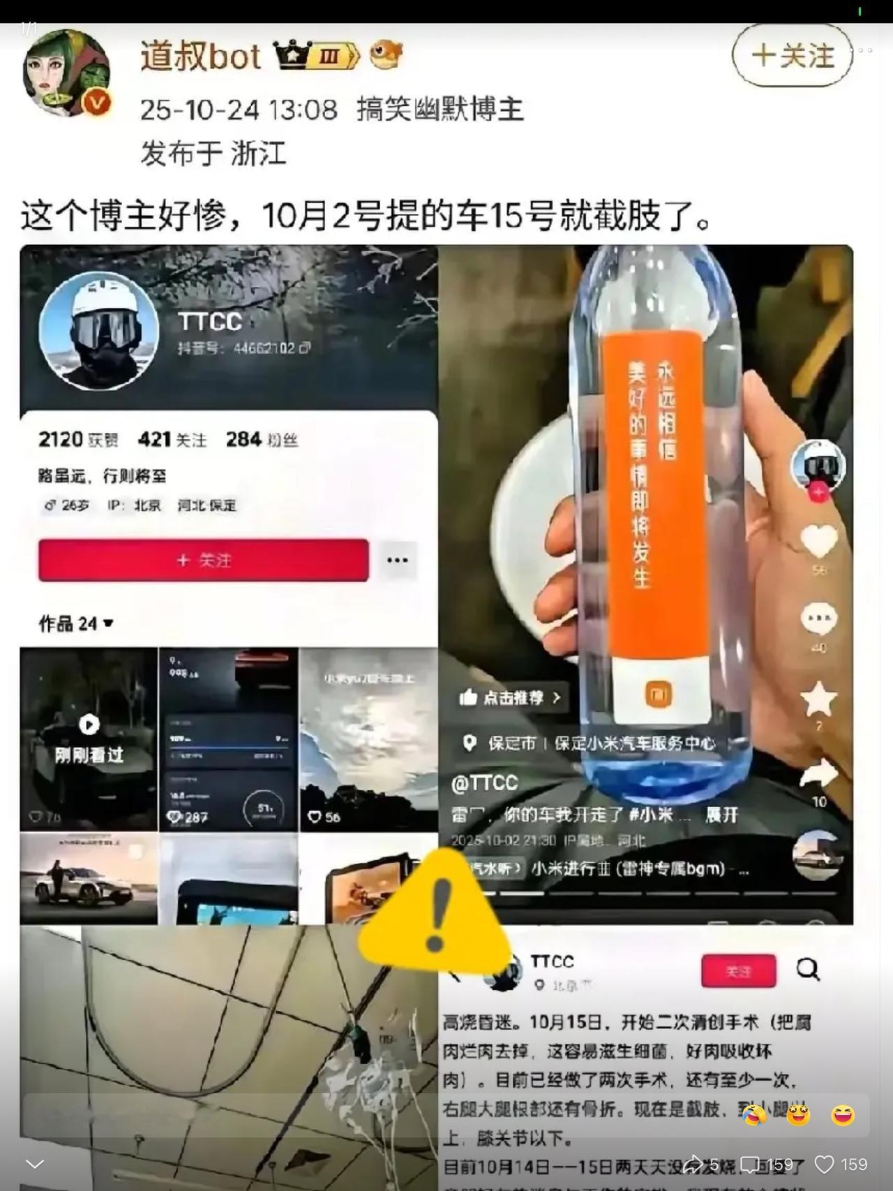 这个博主好惨，10.2提车，15号就截肢了。人生的最后一辆车。以后想开车也只能是