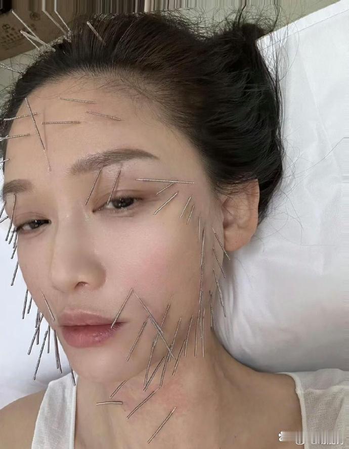陈乔恩太拼了！为针雕忍痛，全身扎如刺猬，这般毅力令人惊叹，美丽背后是无尽忍耐。