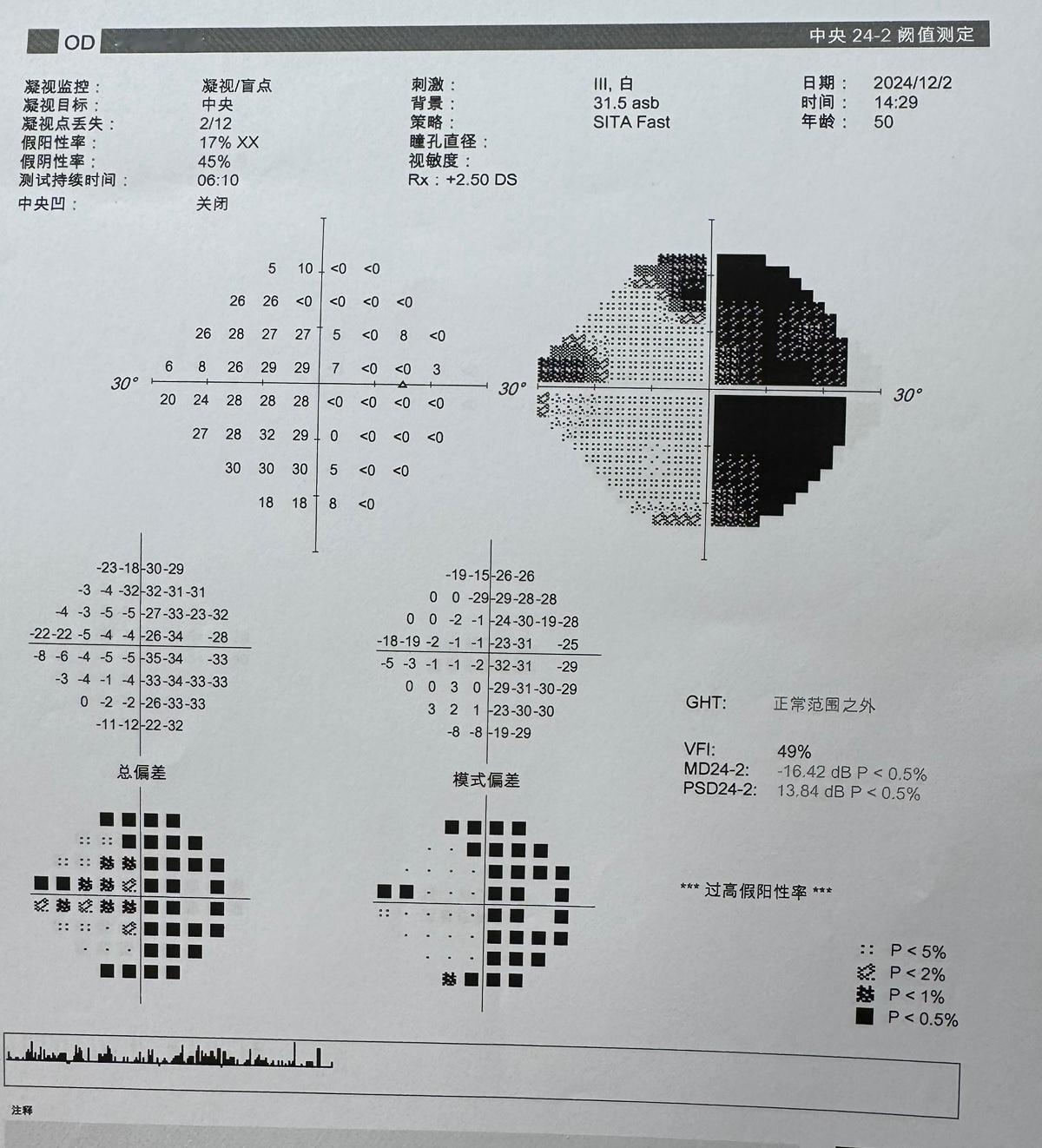 可是，等到三个月，我眼睛连亮都看不着，我着急了，上医院去检查，说：可以有高压氧仓