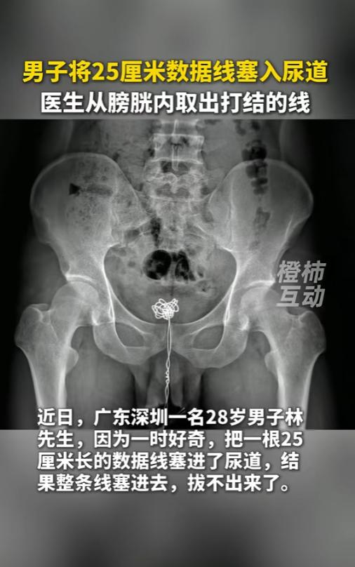 “成年人怎么能干出这种事儿？”6月23日报道，广东深圳，一位28岁的成年男子，竟