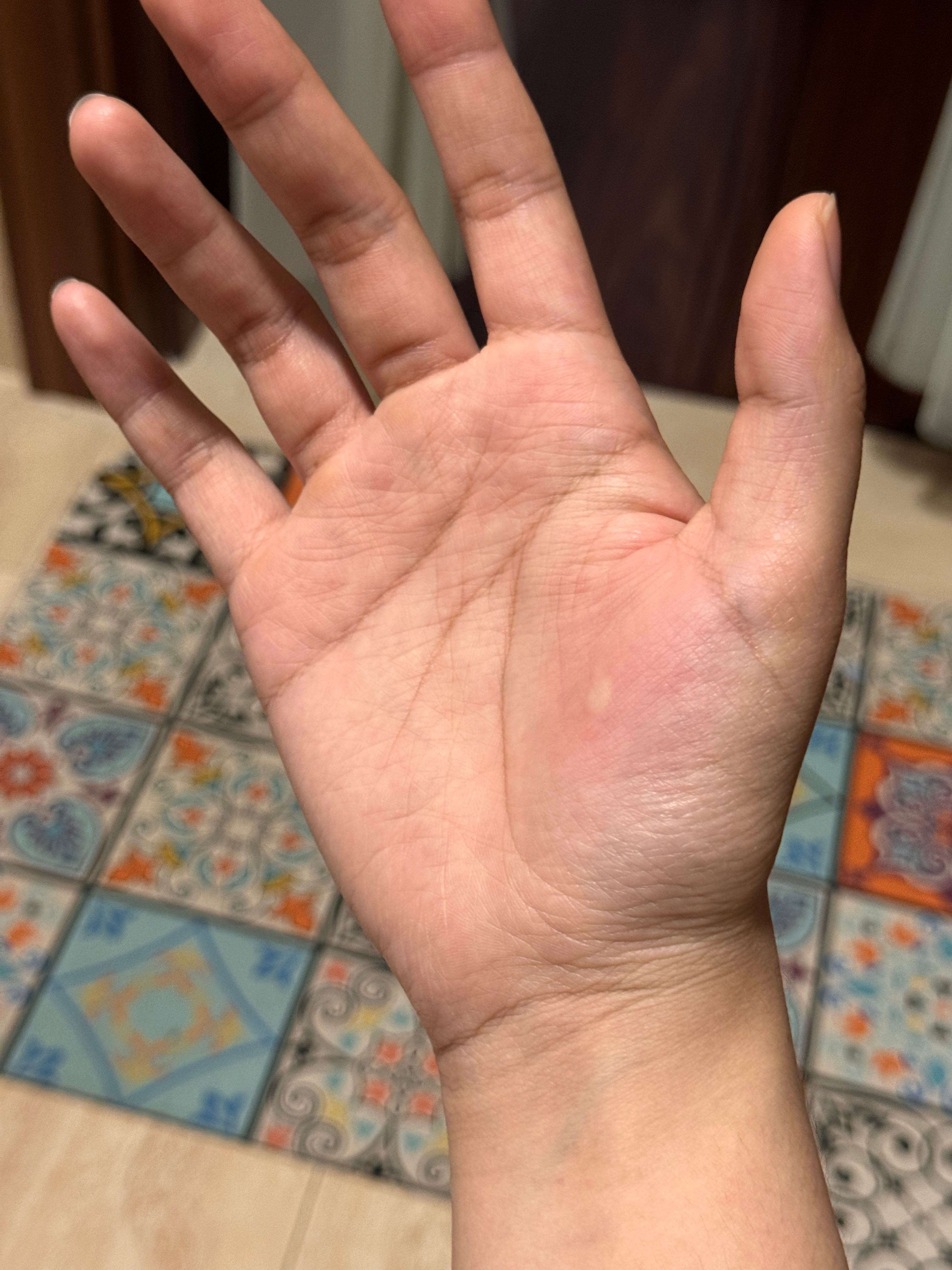 蚊子你死了……我又被咬醒了