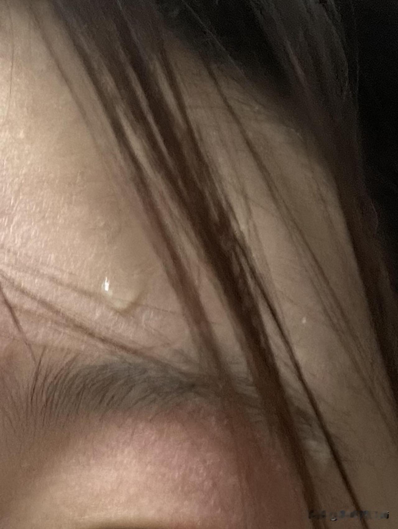 从便秘发现了自己真是个心态很差的人…怎么会有人因为便秘导致有点类似于呼吸碱中毒