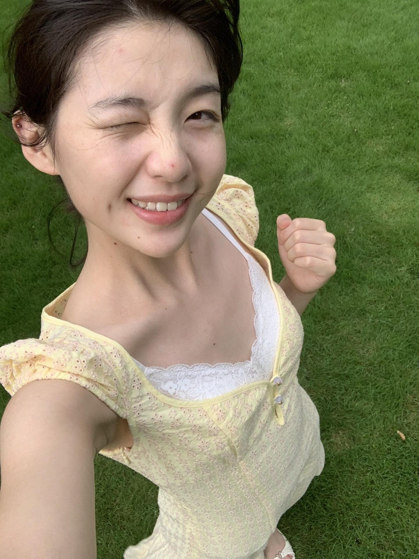 黑眼圈