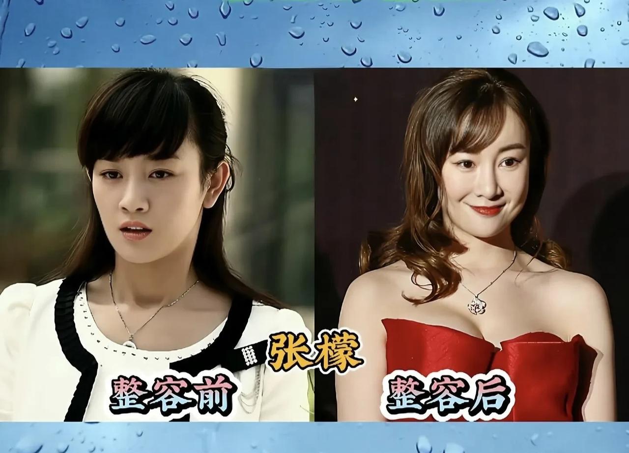 整容过度的8位女明星，你认识几位？整容过度有许多危害，像削骨、填玻尿酸太多，可