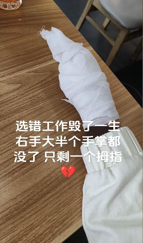 选错工作毁了一生！多少人因为这个机器终身残疾？24岁女子因厂里违规操作，导致机器