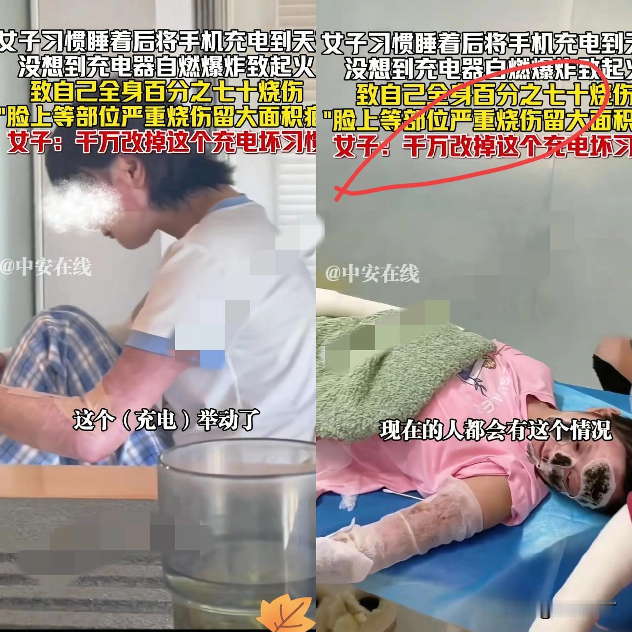 有这习惯的要注意了！湖北一女子睡前把手机搁床边通宵充电，睡梦中一声巨响，手机突