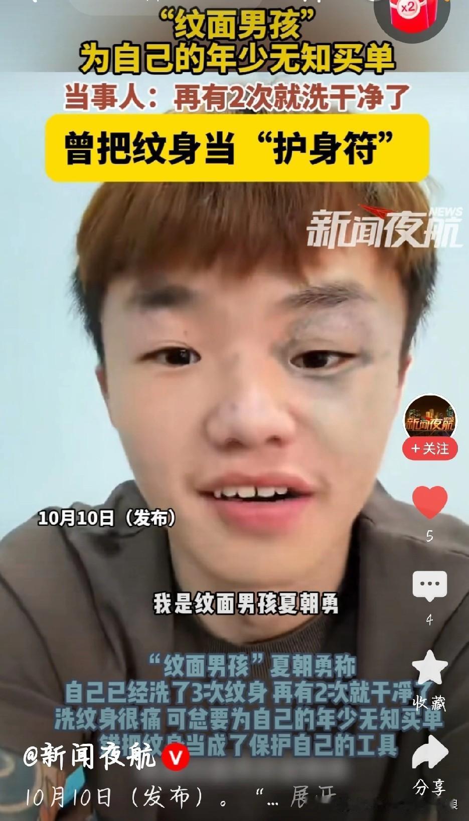 “纹面男孩”说，再洗2次脸就干净了，现在已经扛过3次了。可这哪是洗脸，激光打在脸