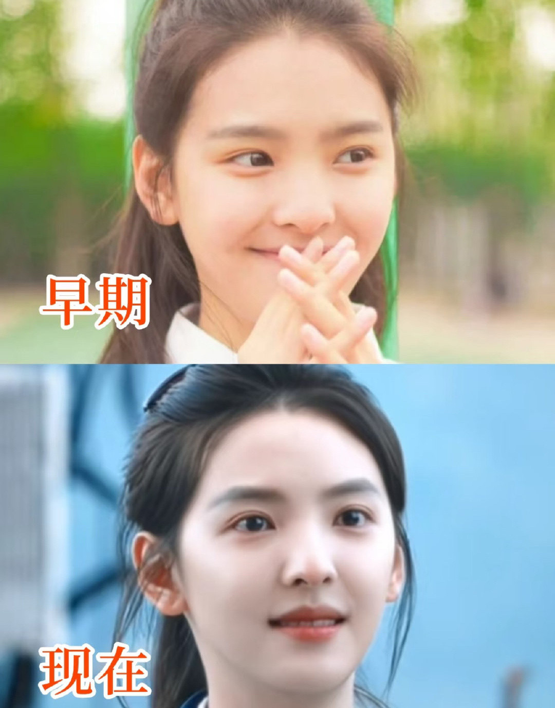 不是章若楠都有人说她整容？我印象中她是出了名的纯天然啊​​​