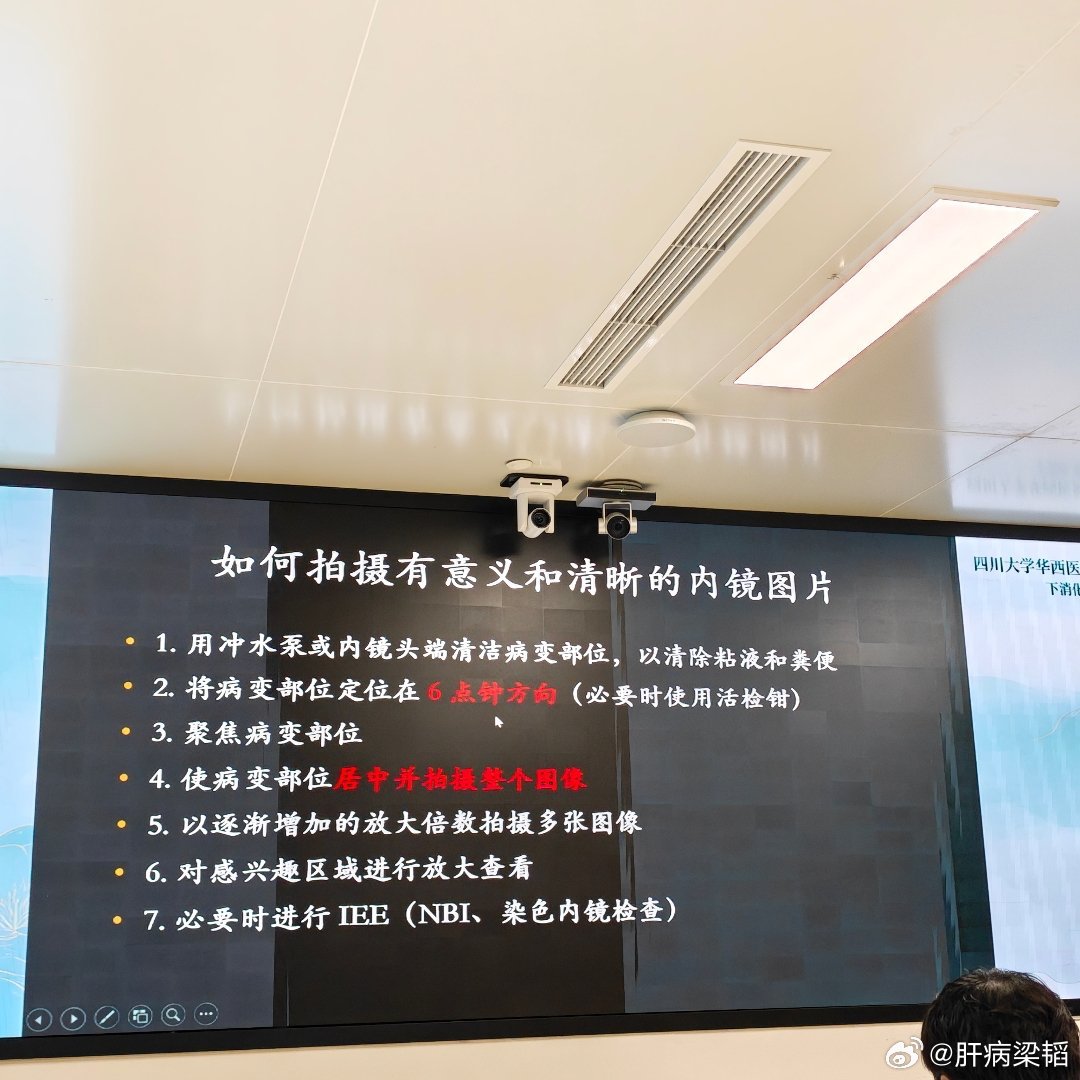 会做，和把一件事做到极致是两个概念，我也天天做肠镜，总例数没1万例，也有几千例了
