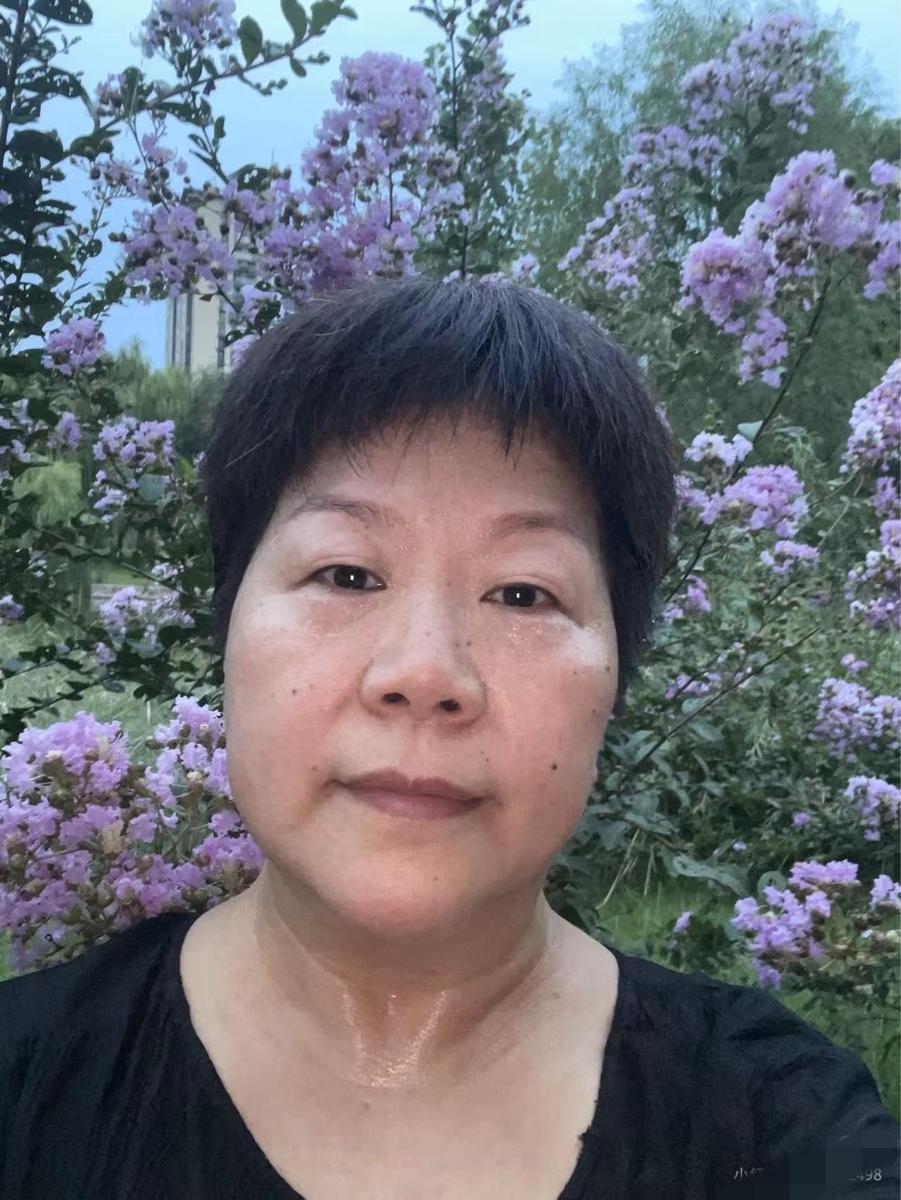 你发现了没有？每个女人到了50岁左右，由于雌激素断崖式下降后慢慢开始绝经这一段时