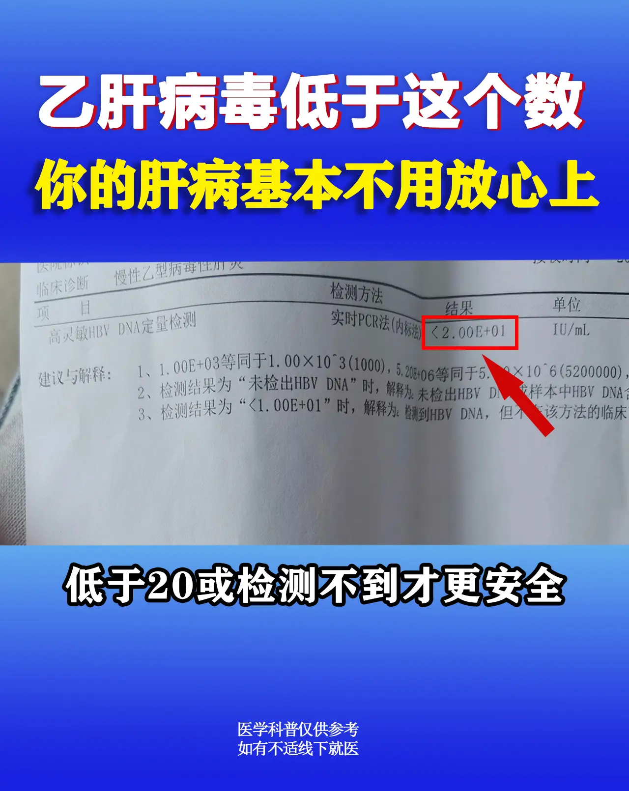 临床上大部分乙肝患者通过抗病毒治疗，病毒量低于20、甚至检测不到，说明...