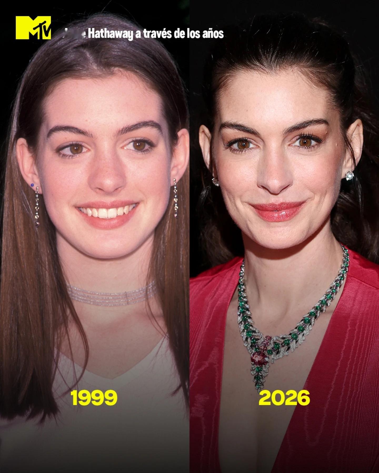 安妮·海瑟薇的颜值变化安妮海瑟薇