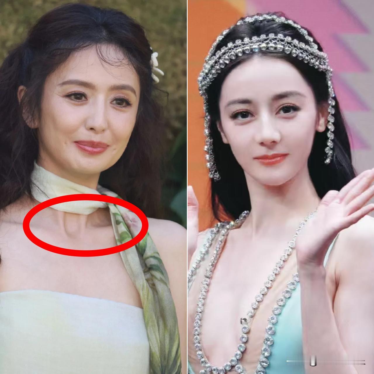 新疆的女生不是很抗老吗佟丽娅41岁就老的很明显了那女神迪丽热巴就还有不