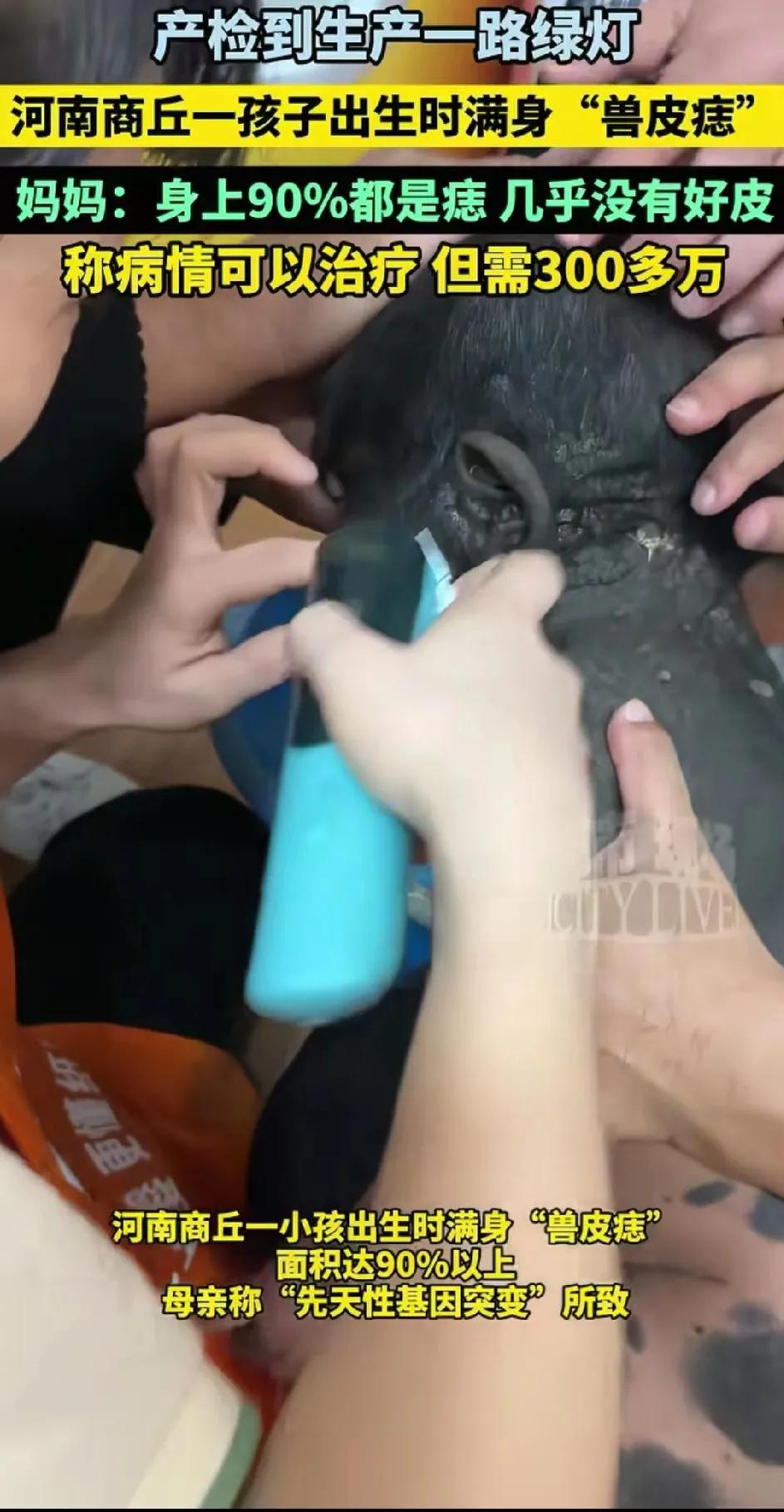 可怜的宝宝太让人心疼了河南一宝妈，大儿子六岁的时候不幸遇到车祸去世一年以后