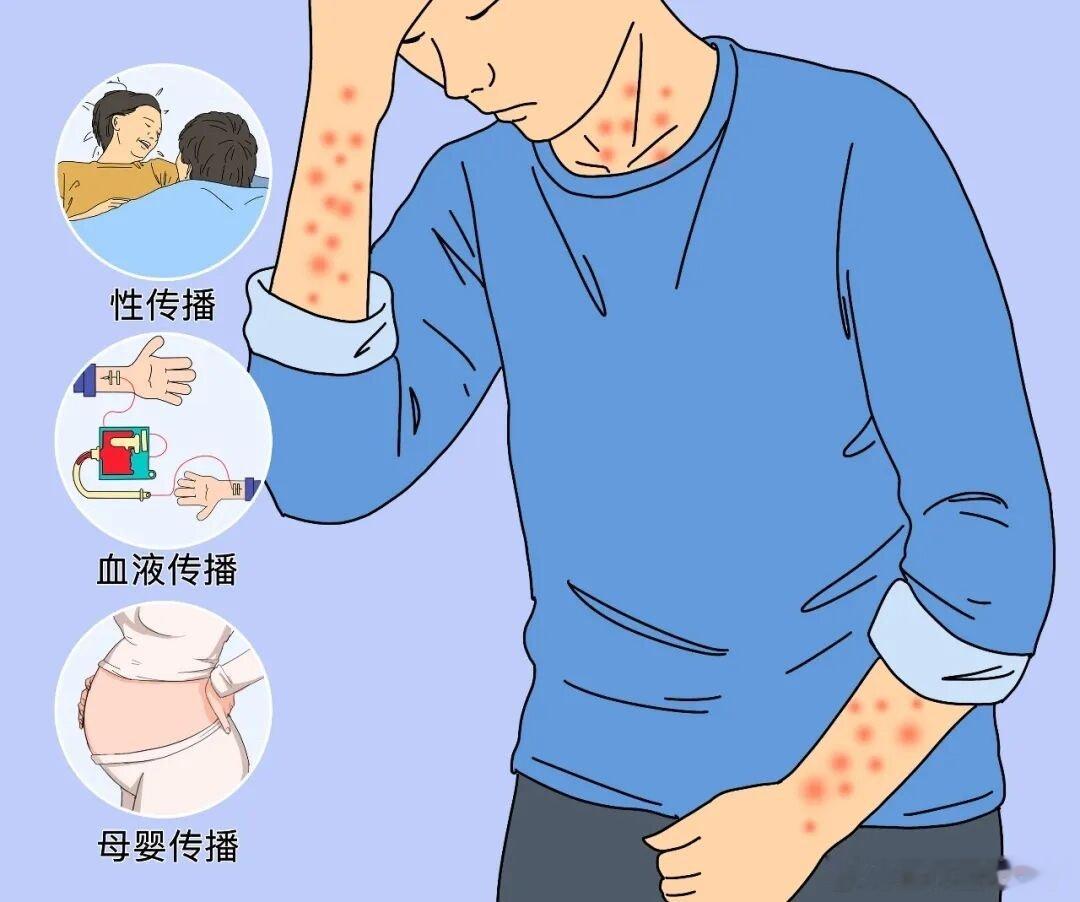 #梅毒被称为皮肤性病科模仿大师##健闻登顶计划#梅毒主要通过性接触传播，日常普通接触不会感染，不用过